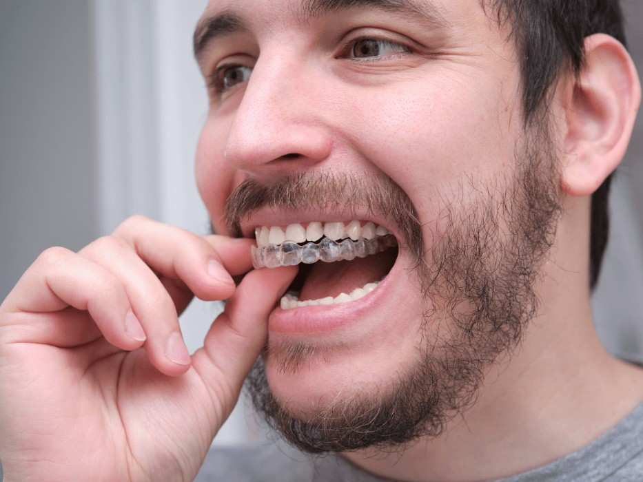 is-a-diamond-invisalign-provider-good