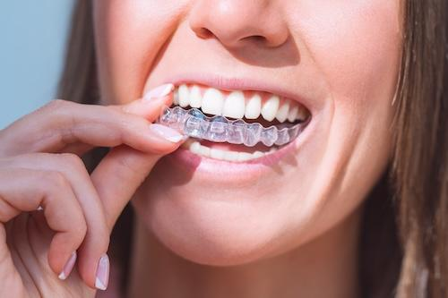 the-blue-dot-secret-invisalign-teen-compliance-during-the-holidays