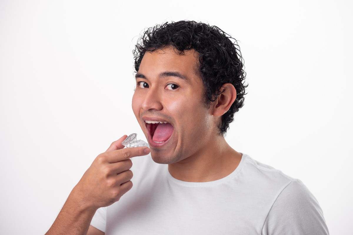 invisalign-munchies-how-to-use