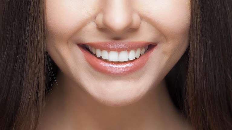 dental implants dedham | woman smiling